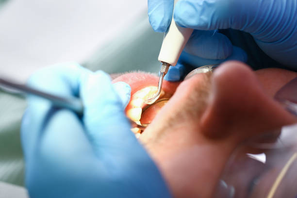 Best Broken or Chipped Tooth Repair in Fuller Heights, FL